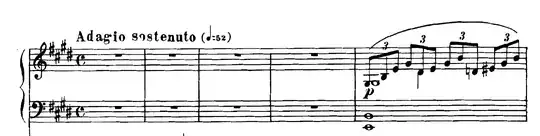 4 triplets, with 3 accents total