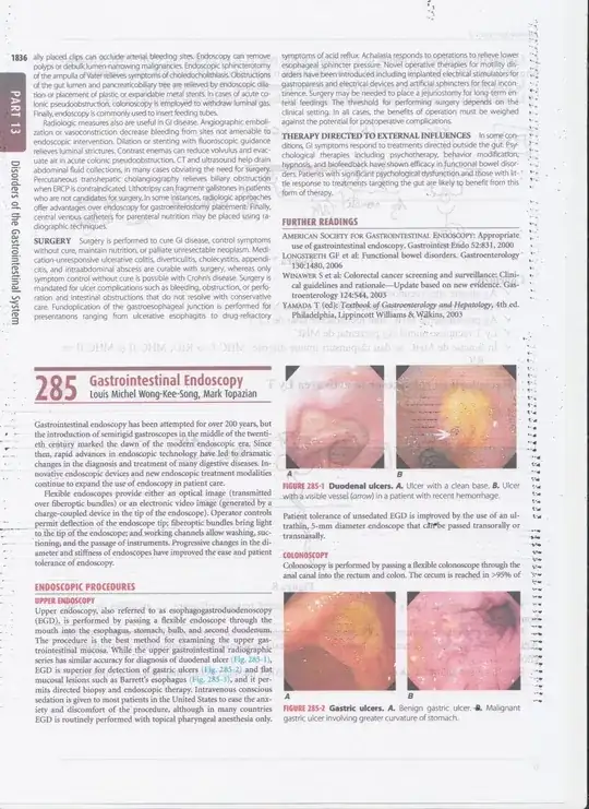 Screenshot of Windows Features settings showing Sandbox enabled and Hyper-V disabled