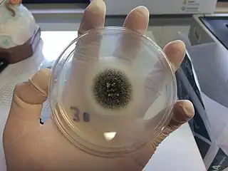 Aspergillus niger: granular colonies with a white edge and central black pigmentation: 187–8