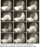 Imaging at true TV scanning rate in ESEM: Water microdroplets from capillary needle on tissue paper. Photos from TV monitor displaying single frames of video recording. Unprocessed BSE signal, field width 380&nbsp;µm.
