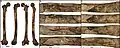 Burial 15. Perimortem fractures on the right femur