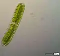 Netrium oblongum. A saccoderm "desmid"
