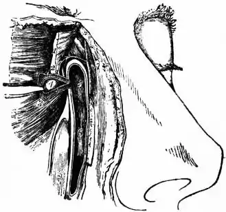 EB1911 Eye - Fig. 3.—Lachrymal Canals and Duct.jpg