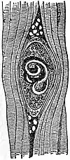 EB1911 Nematoda - Trichinella.jpg