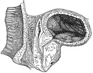 EB1911 Reproductive System, in Anatomy - section of bladder, prostate and rectum.jpg