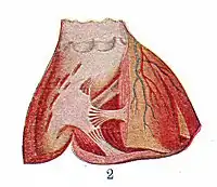 The heart showing interior-extract.jpg