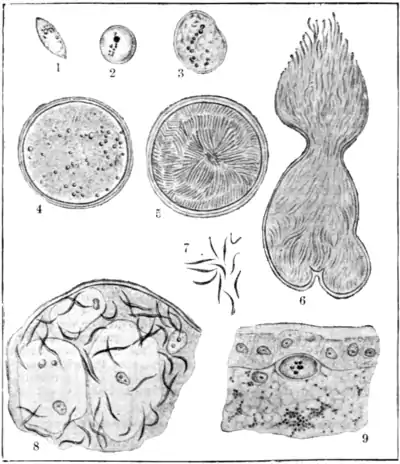 Tropical Diseases - Fig 12.png