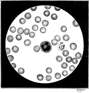 Tropical Diseases - Fig 16.png