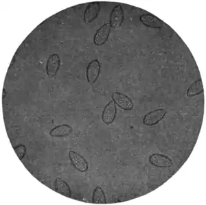 Tropical Diseases - Fig 165.png