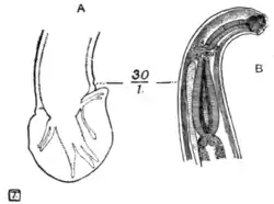 Tropical Diseases - Fig 182.png
