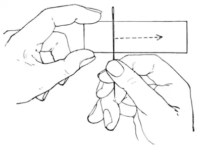 Tropical Diseases - Fig 19.png