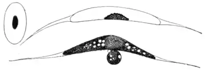 Tropical Diseases - Fig 251.png